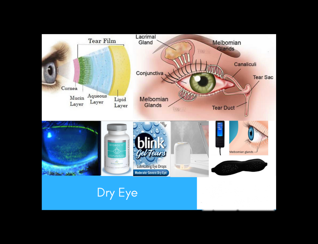 Dry eye