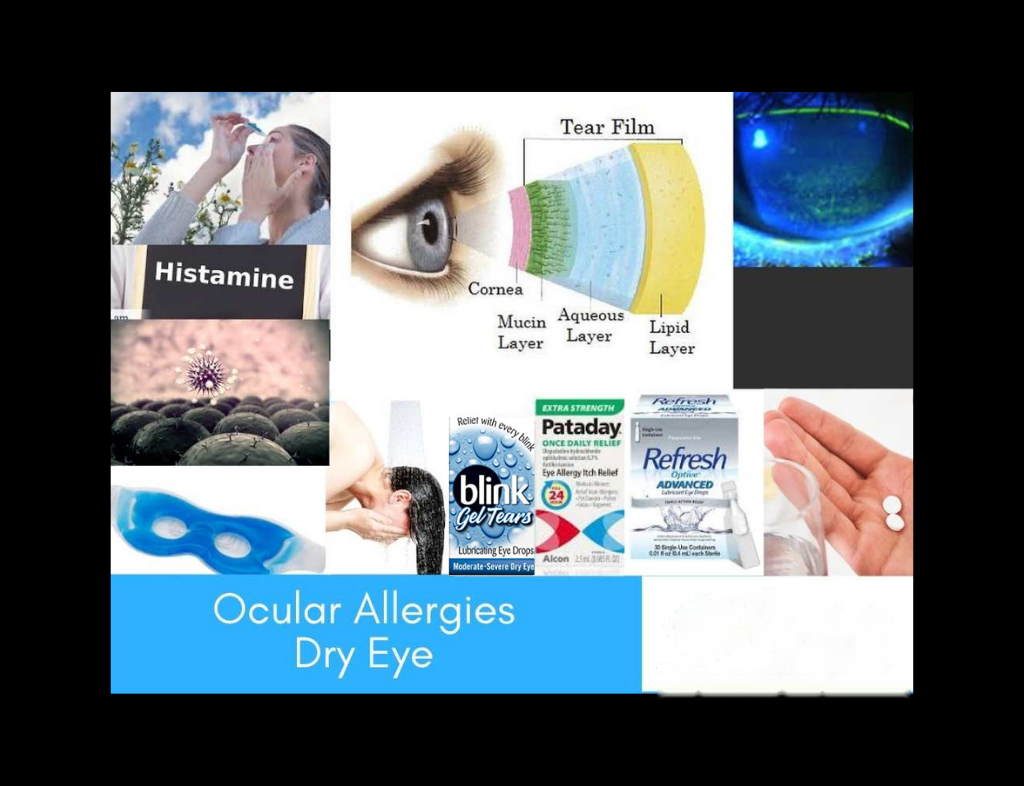 Eye allergies
